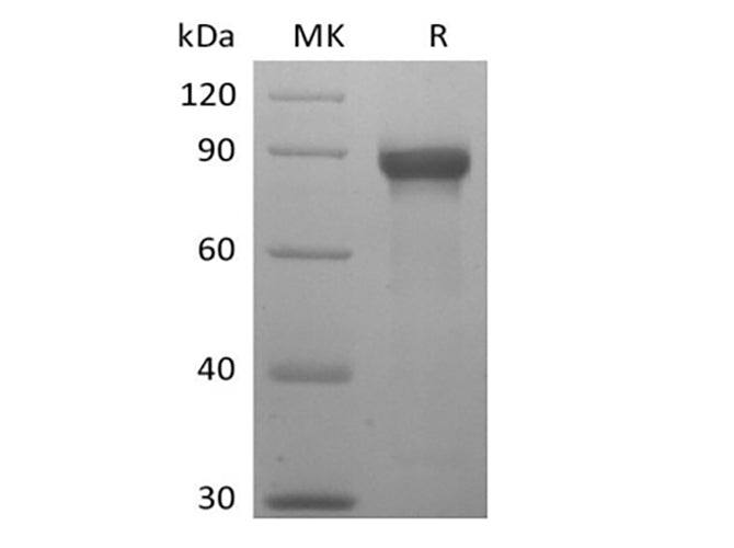 Recombinant Human Siglec-8 (C-mFc)