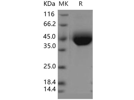 Recombinant Human SIGLEC3/CD33 Protein (His Tag)