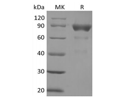 Recombinant Human SIRPB2 (C-Fc)