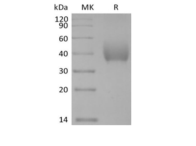 Recombinant Human SLAM Family Member 7/SLAMF7/CD319/CRACC (C-6His-Avi) Biotinylated