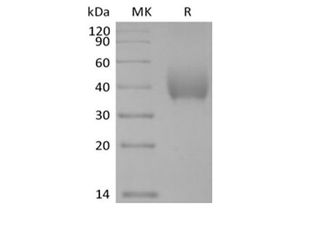 Recombinant Human SLAM Family Member 7/SLAMF7/CD319/CRACC (C-6His-Avi) Biotinylated