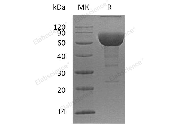 Recombinant Human SLAMF6/Ly108 Protein (aa 22-225, Fc Tag)