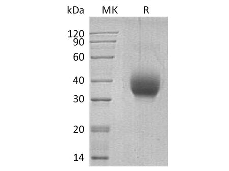 Recombinant Human SLAMF6/Ly108 Protein (aa 28-225, His Tag)(Active)