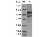 Recombinant Human SPOCK1/Testican 1 Protein (aa 21-429, His Tag)