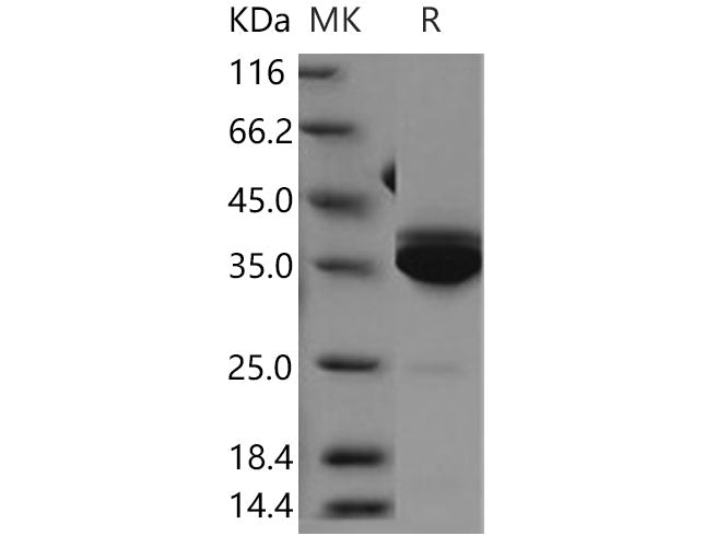 Recombinant Human Statherin/STATH Protein (Fc Tag)