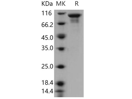 Recombinant Human STK16/PKL12/MPSK Protein (His & NusA Tag)