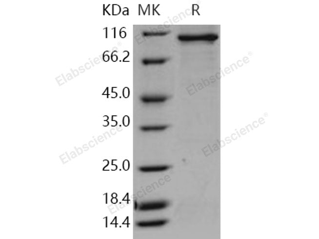 Recombinant Human STK23/MSSK1/SRPK3 Protein (His & GST Tag)