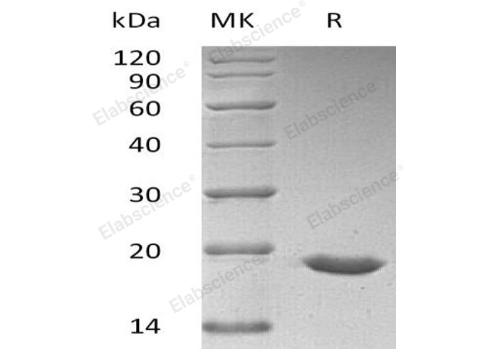 Recombinant Human SUMO3/SMT3A Protein (aa 1-103, His Tag)