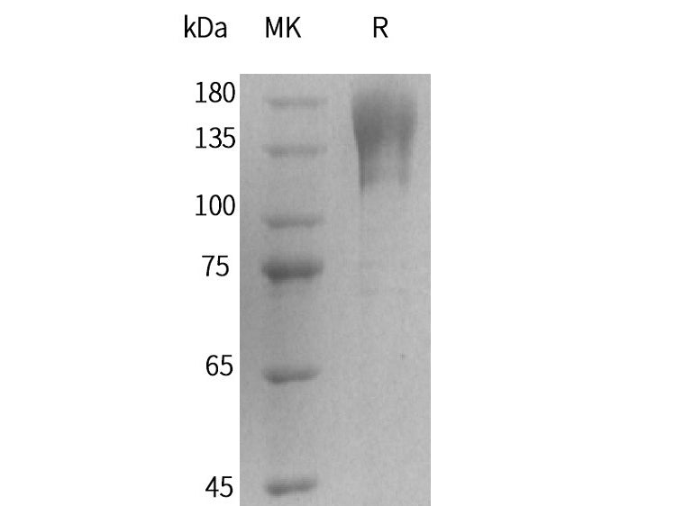 Recombinant Human T-cell Surface Protein Tactile/CD96(C-Fc) 