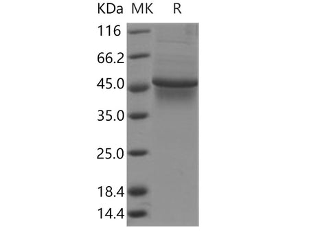 Recombinant Human TAPBP/ Tapasin Protein (His Tag)