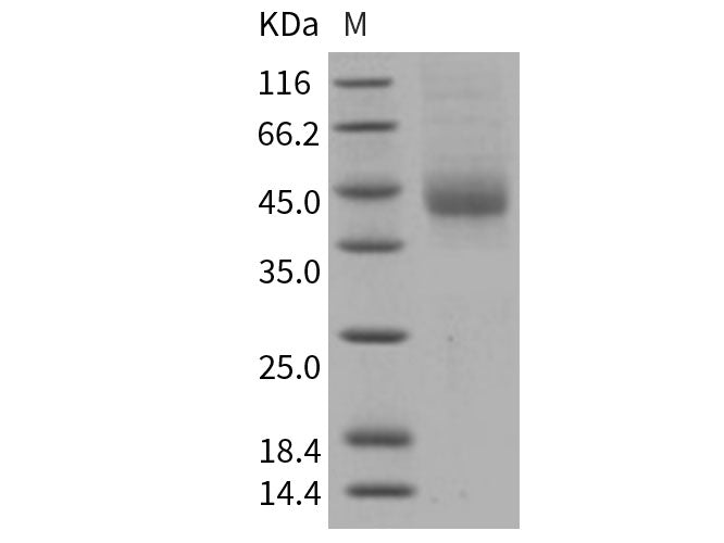 Recombinant Human TFPI Protein (His Tag)(Active)