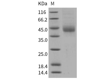 Recombinant Human TFPI Protein (His Tag)(Active)