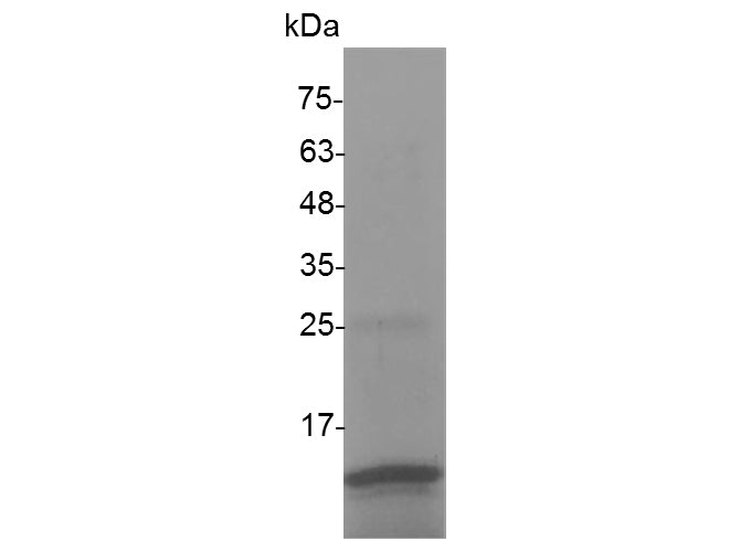 Recombinant Human TGF beta 2 protein(N-His)(active)