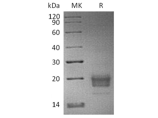 Recombinant Human TIGIT Protein (His & Avi Tag)