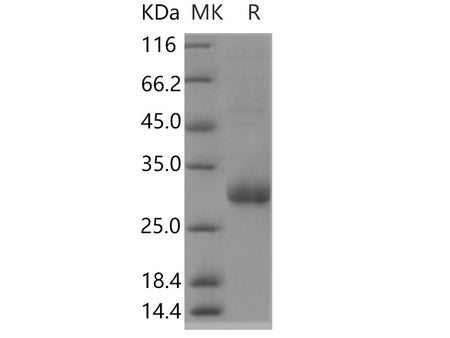 Recombinant Human TMED1 Protein (His Tag)(Active)