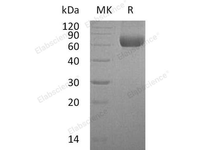 Recombinant Human TMPRSS11B Protein (His Tag)