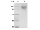 Recombinant Human TNFRSF8/CD30L Receptor/CD30 (C-mFc)
