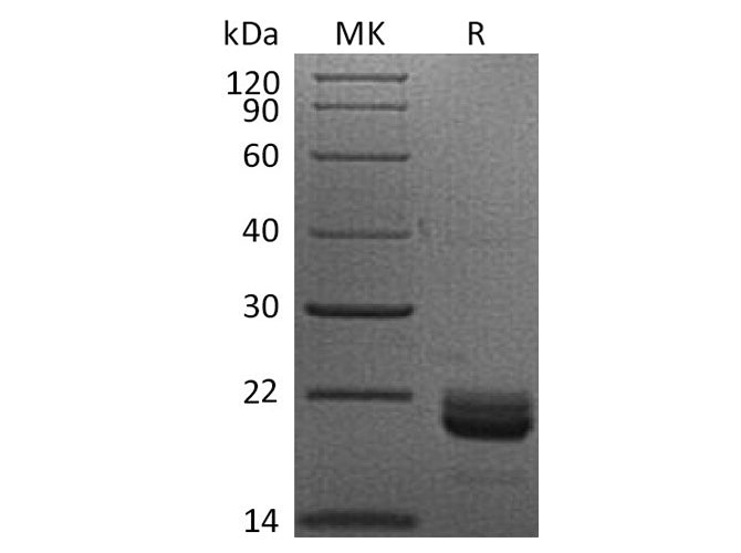 Recombinant Human TNFSF14/LIGHT Protein (His Tag) Purity >95%