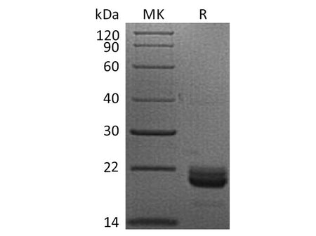 Recombinant Human TNFSF14/LIGHT Protein (His Tag) Purity >95%