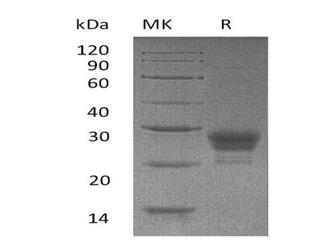 Recombinant Human TNFSF4/OX40L Protein (His Tag)(Active)