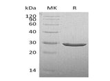 Recombinant Human TPK1 Protein (His Tag)