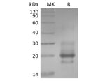 Recombinant Human TRAIL R1 / DR4 / TNFRSF10A (C-6His)