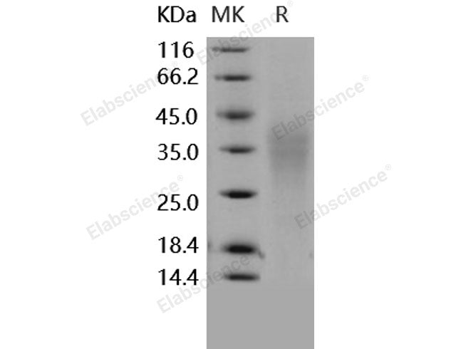 Recombinant Human TRAIL R4/TNFRSF10D Protein (His Tag)(Active)