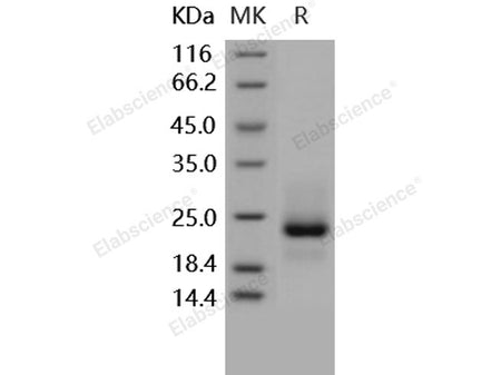 Recombinant Human TRAILR1/TNFRSF10A Protein (His Tag)(Active)