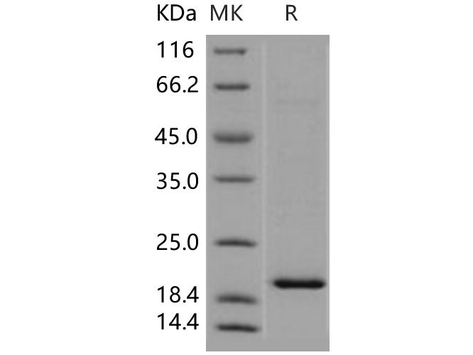 Recombinant Human TSC22D1 Protein (His Tag)