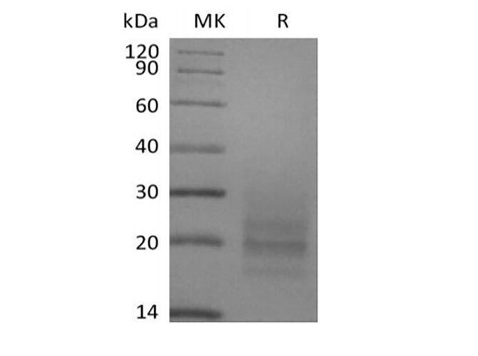 Recombinant Human TSLP R/CRLF2 (C-Fc)