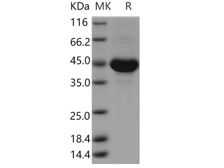 Recombinant Human TSPAN8/Tetraspanin 8 Protein (Fc Tag)