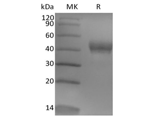 Recombinant Human Tumor-associated Calcium Signal Transducer 2/TROP-2 (248AA, C-6His)