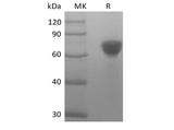 Recombinant Human Tumor-associated Calcium Signal Transducer 2/TROP-2 (248AA, C-Fc)