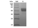 Recombinant Human Tumor-associated Calcium Signal Transducer 2/TROP-2 (C-Avi-6His) Biotinylated