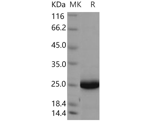 Recombinant Human UBE2F Protein (His Tag)
