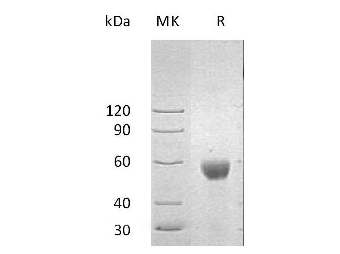 Recombinant Human ULBP2/N2DL-2 Protein (Fc Tag)(Active)