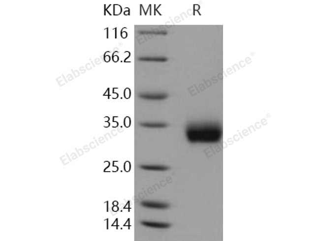 Recombinant Human ULBP2/N2DL-2 Protein (His Tag)