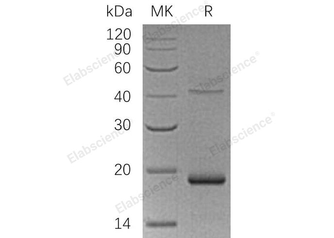 Recombinant Human UPP1 Protein (His Tag)