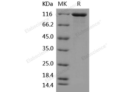 Recombinant Human VCL/Vinculin Protein (His Tag)