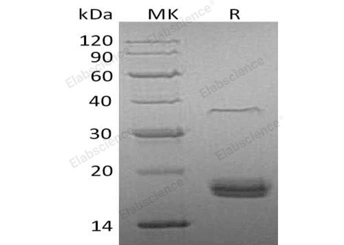 Recombinant Human VEGF-D/VEGFD Protein (His Tag)