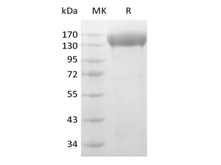  Recombinant Human VEGF Receptor 2/VEGF R2/FLK-1/KDR (C-6His-Avi) Biotinylated