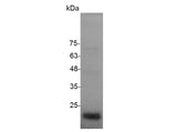 Recombinant Human VEGF165 protein(N-His)(active)