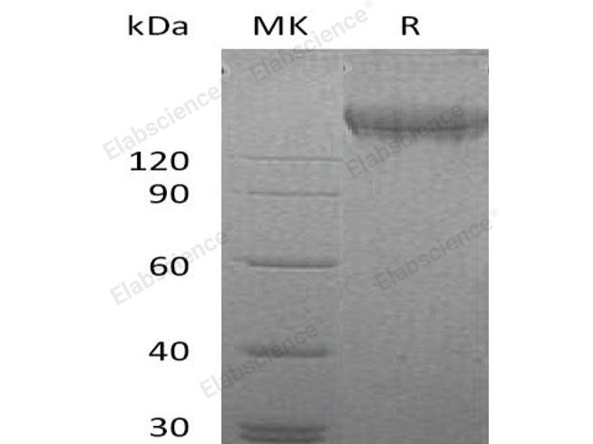 Recombinant Human VEGFR2/Flk-1/KDR Protein (His &GST Tag)(Active)