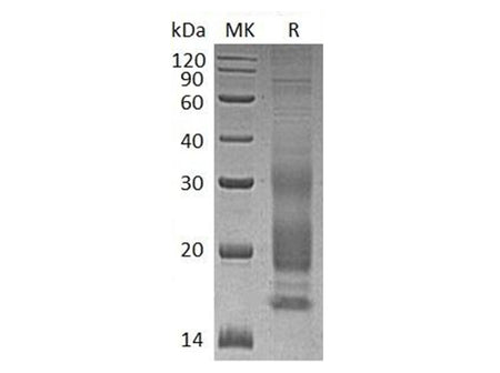 Recombinant Human VIP Protein (His Tag)
