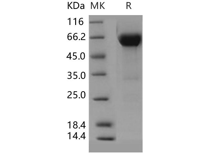 Recombinant Human VSIG4 Protein (Fc Tag)