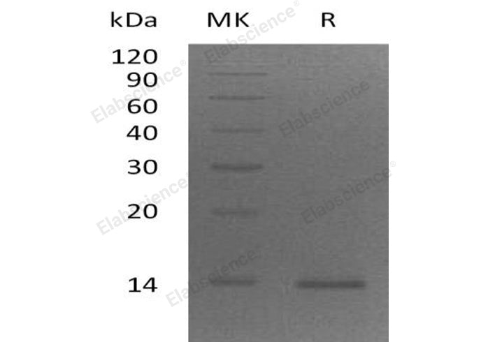 Recombinant Human ZBED1 Protein (His Tag)