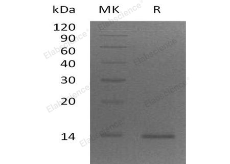 Recombinant Human ZBED1 Protein (His Tag)