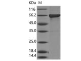Recombinant Influenza B (B/Florida/4/2006) Nucleoprotein/NP Protein (His Tag)