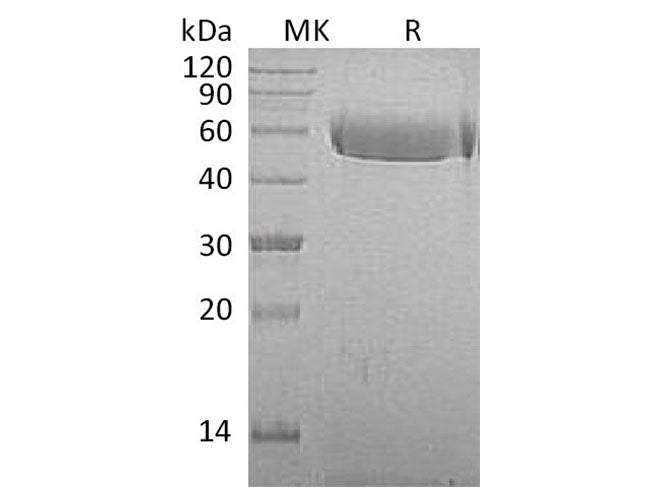 Recombinant Macaca mulatta AHSG/Fetuin A Protein (His Tag)