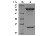 Recombinant Macaca nemestrina PCSK9/Proprotein Convertase 9 Protein (His Tag)